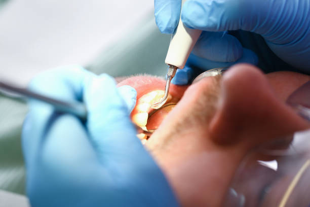 Best After-Hours Dental Care in Jacinto City, TX