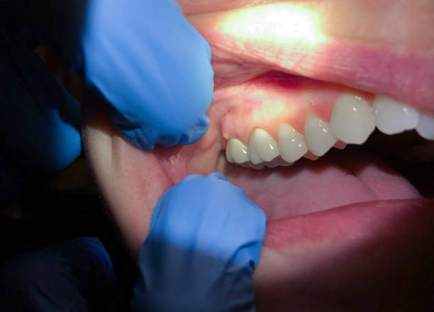 Best 24-Hour Emergency Dental Care in Jacinto City, TX